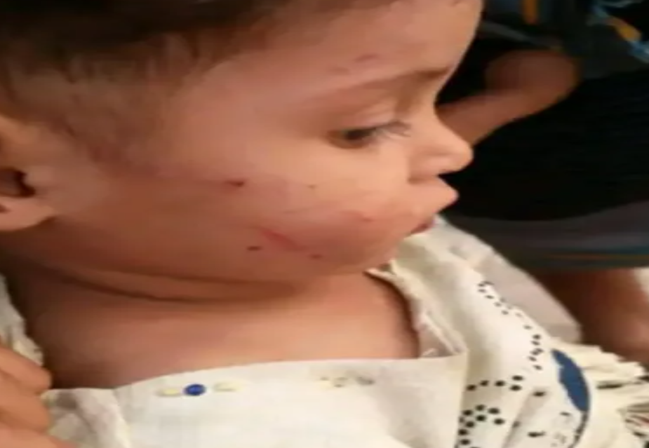 مطالبات عاجلة بالتدخل وحماية الطفل...صور مروّعة توثق اعتداء أب على طفله بمحافظة المحويت 