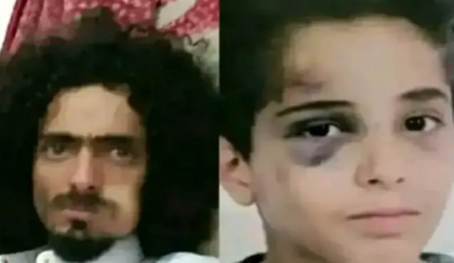 هزت العاصمة صنعاء...من هم آل بادي؟.. القصة وراء اعتداء وحشي على طفل 